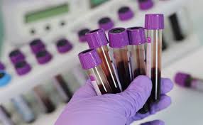 Comprehensive Thyroid Panel Test